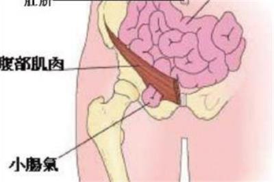 行业资讯-手术后抗感染的复合静电纺丝纳米纤维膜疝修补片